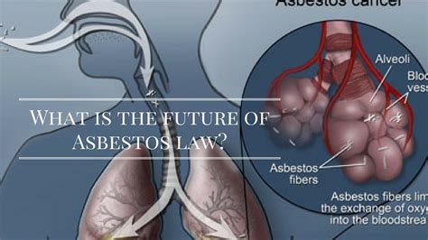 Check spelling or type a new query. Mesothelioma Asbestos - YouTube