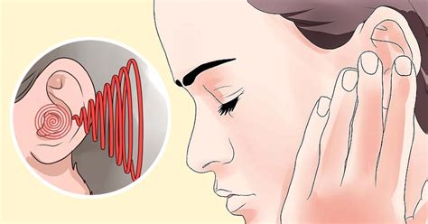 Silencie El Zumbido Constante En Sus Oídos Con Estos 5 Remedios