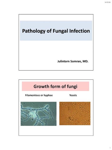 Pdf Pathology Of Fungal · Pdf File141056 3 Superficial Mycoses