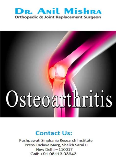 Are you searching for a top ranked surgeon, physician or specialist in orthopedics, rheumatology, or sports medicine? Pin by Dr.Anil Mishra on Treatment | Joint replacement ...