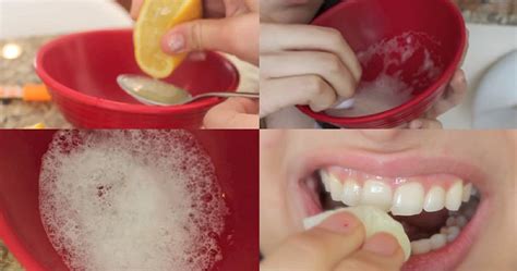 There are actually tiny pits in the enamel. Get Rid Of Yellow Stains From Your Teeth With This ...