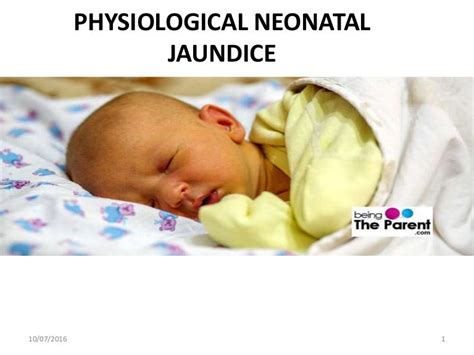 Physiological Neonatal Jaundice