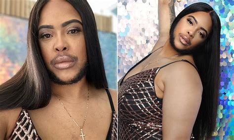 Woman Who Suffers From Hormonal Disorder Which Makes Facial Hair Grow Decides To Embrace Her