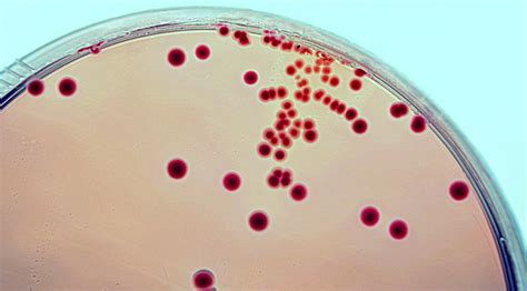 Drug resistant UTI bacteria can hide in the gut