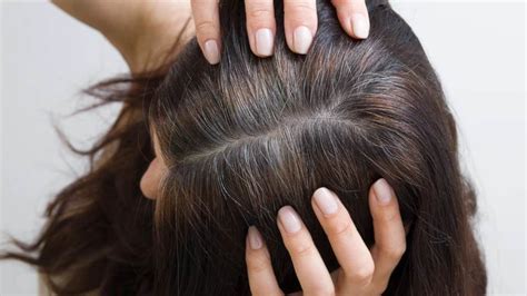 Premature Hair Greying 5 Potential Reasons And Causes