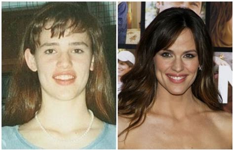 15 Photos Of Celebrities Who Used To Look Like Total Nerds Celebrities