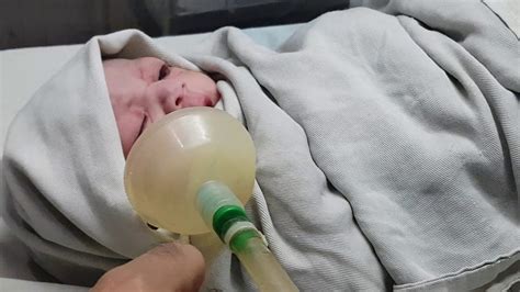Newborn Baby Breathing Problem Youtube