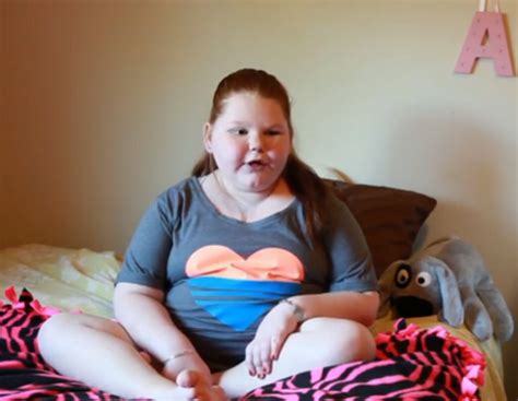 13 Year Old Girl With Rare Uncontrollable Weight Gain Loses 60 Pou