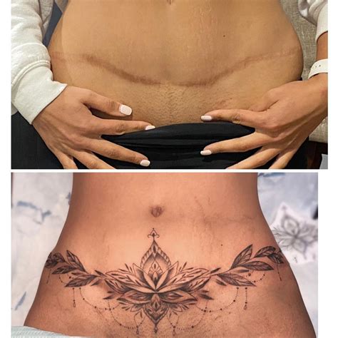 Aggregate More Than 69 Feminine Tummy Tuck Scar Cover Tattoo In Eteachers