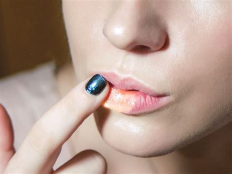 Infection on lip can be due to many causes. Split Lip: Treatment, Causes, Vitamin Deficiency, and ...