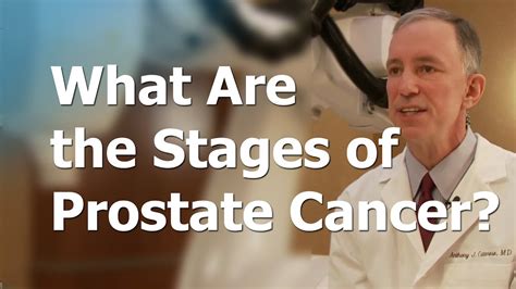 Prostate Cancer Stage 1