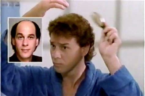 Sperling was newly single at 26 and felt self conscious about his receding hairline and thought it would ruin his chances of finding a woman. Hair Club for Men Sold to Japanese Wig Maker - WSJ