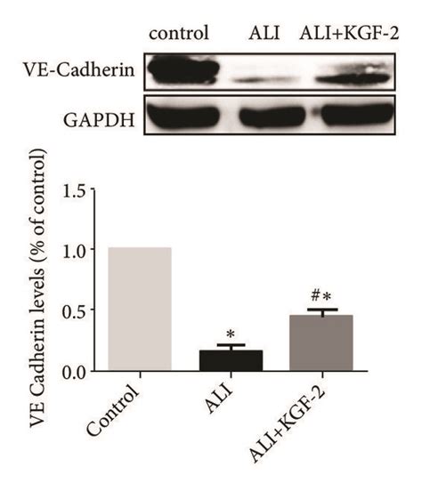 Western Blot Analysis Of Claudin 5 ZO 1 And VE Cadherin Expression In