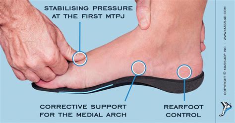 Clinicians Blog By Mass4d® Insoles Tagged Foot Biomechanics Mass4d