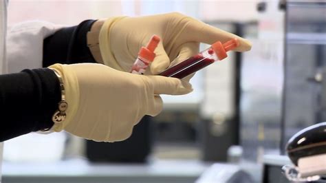 Ab welchen werten spricht man überhaupt von hypertonie und wann wird es gefährlich? Cholesterin, Blutdruck & Co.: Das Geschäft mit den ...