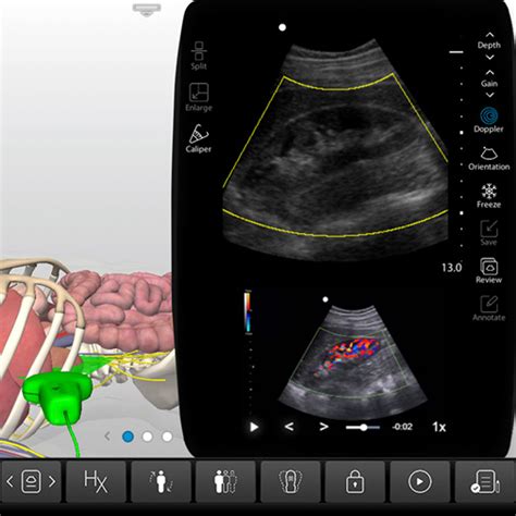 Upper Abdomen Ultrasound And Lower Abdomen Ultrasound Training