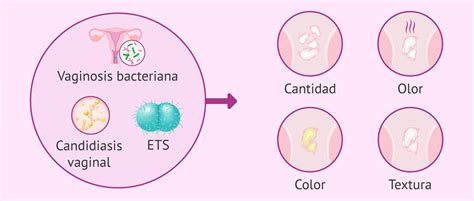 Es Normal Tener Flujo Vaginal Para Qu Sirve Y Cu Ndo Es Anormal