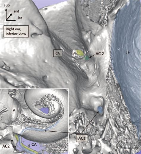 Micro Ct And 3d Reconstruction Of A Right Human Temporal Bone Depicting