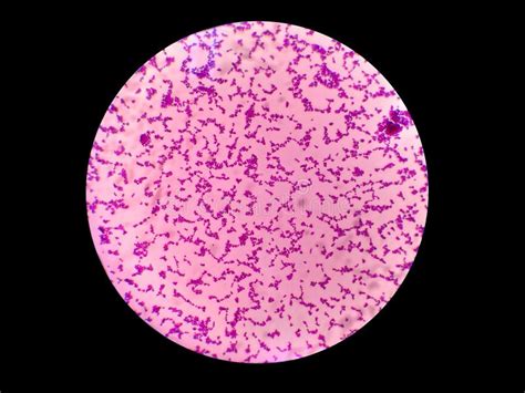 Gram Positive Cocci Bacteria