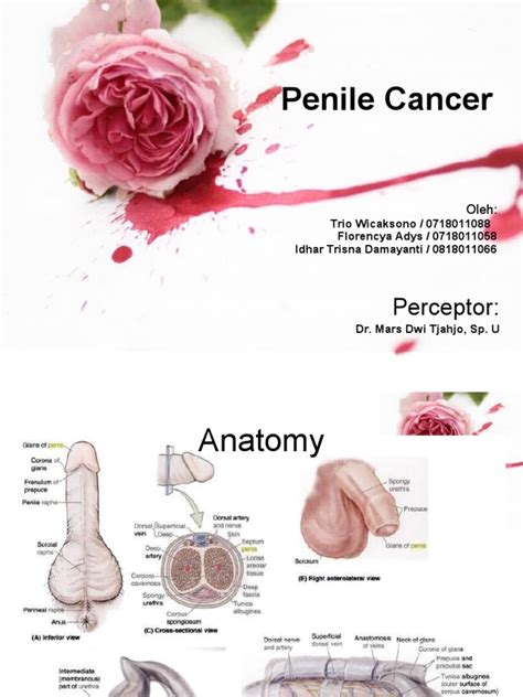 Penile Cancer Metastasis Neoplasms
