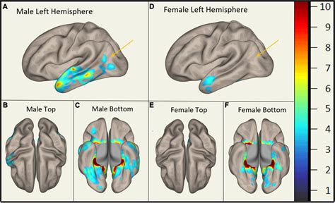 Frontiers Sex Differences In Brain Functional Connectivity Of Hippocampus In Mild Cognitive