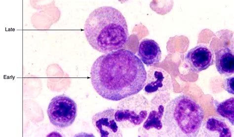 Early Myelocyte Nucleus Is Light Purple And Slightly Off Center
