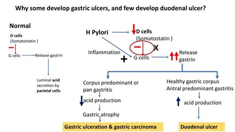 H Pylori Gastritis Pathology Made Simple