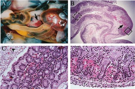 Histological Analysis Of Hemorrhage In The Wall Of The Cecum Of Nkcc1