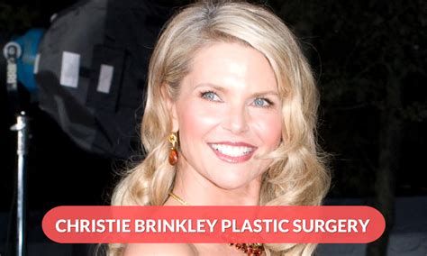 All The Details About Christie Brinkley Plastic Surgery Regaltribune