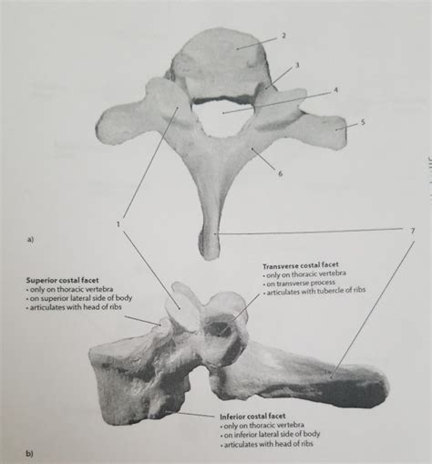 Solved 7 Superior Costal Facet Only On Thoracic Vertebra On