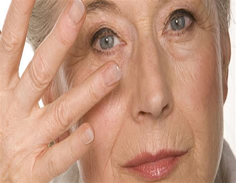 الوقاية من بقع الشيخوخة علاج بقع الشيخوخة كيف تتخلص من بقع الشيخوخة