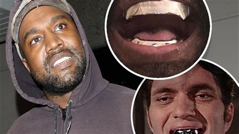 Kanye West Replaced His Teeth With Titanium Dentures Youtube