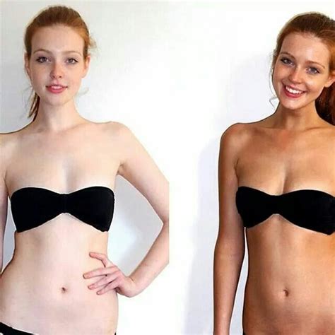 Aviva Labs Before And After Picture Best Tanning Lotion Safe Tanning Tanning Tips
