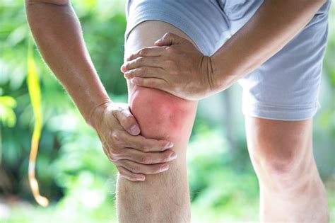 Knee Osteoarthritis Phenotypes With Distinct Pain Trajectories