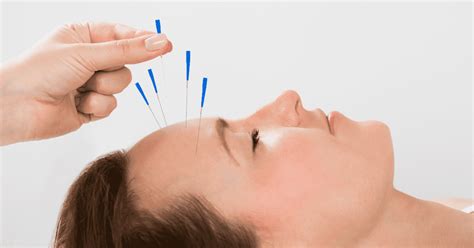 Discover The Best Acupuncture Clinic In Scarborough For Optimal Health