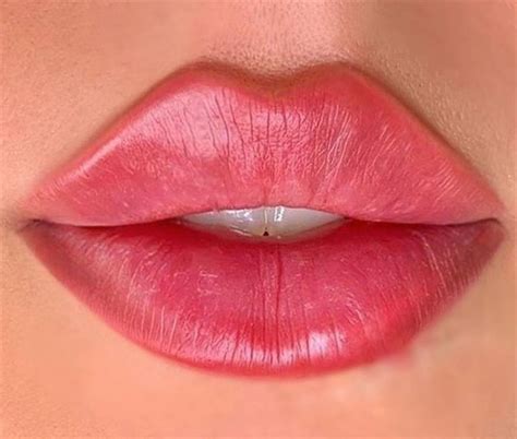 why russian lips are the hottest new trend facial fillers dermal fillers lip fillers big lips