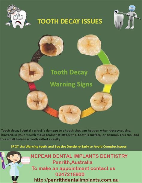 What Is Tooth Decay Sign Of Tooth Decay Problem Look At This