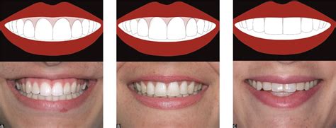 Smile Anatomy Grand Oaks Orthodontics