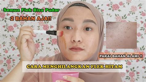 Cara Menghilangkan Flek Hitam Cuma 2 Bahan Alami Aja Youtube