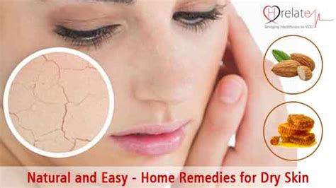 Natural And Easy Home Remedies For Dry Skin