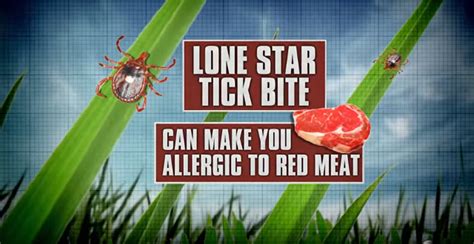 A Lone Star Tick Bite Could Make You Allergic To Red Meat