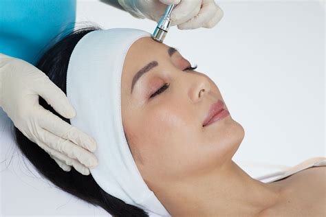 Microdermabrasion The Cosmetic Clinic