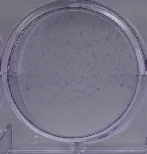 Crystal Violet Staining Openwetware
