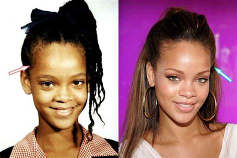 Has Rihanna Had Plastic Surgery Before And After Photos 2021