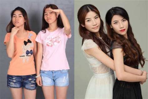chinese women before and after plastic surgery procedures 19 photos klyker