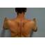Exercises For Upper Back Pain Between Shoulder Blades  Body Tips