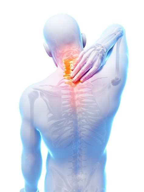Learn How Chiropractic Care Can Treat Neck Pain Chiropractic Directory