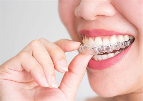 Invisalign Doctor Site Login How To Login And Register