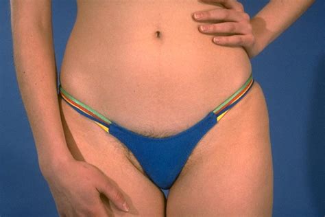 Technically it's not pubic hair. Bikini Science--JE8906