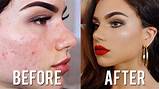 How To Use Makeup To Cover Scars Images